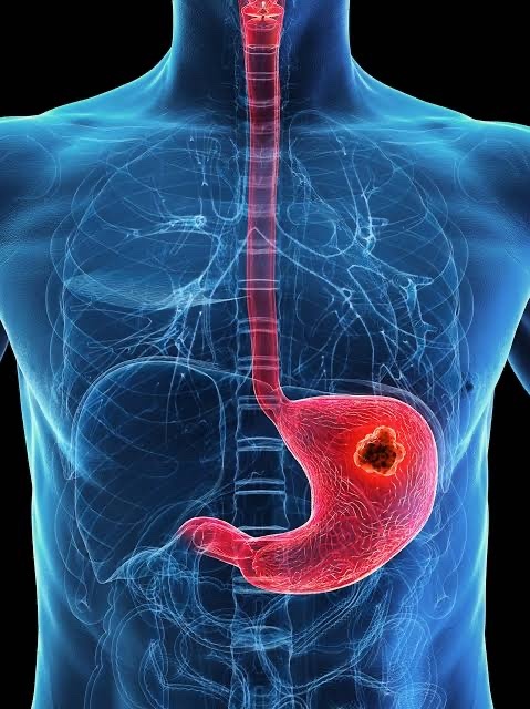 Menopause Clinic in Ahmedabad