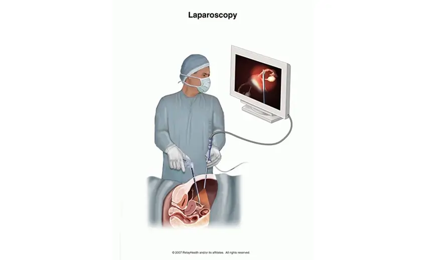 Best Laparoscopic Surgeon in Ahmedabad