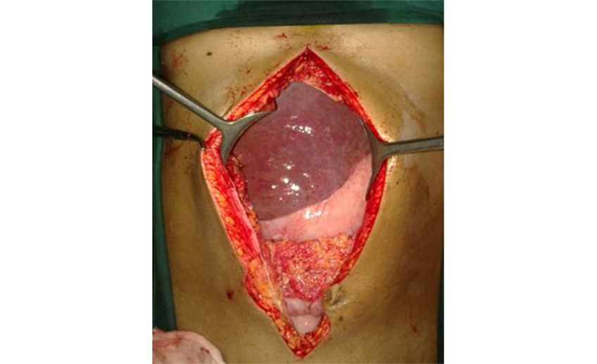 re operative surgery