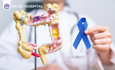 Preventing Colon Cancer through Lifestyle Changes