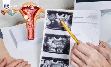 Dealing with PCOS, Fibroids, and Cysts