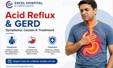 Acid reflux symptoms and treatment guide