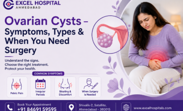 Ovarian Cysts – Symptoms, Types & When You Need Surgery